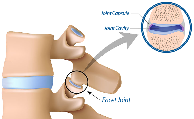 Facet Disease or Facet Syndrome Dr. Abhijit Pawar
